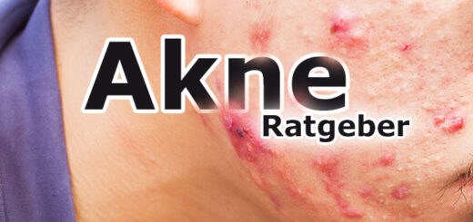 Akne Ratgeber