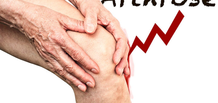 Arthrose