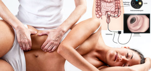 Darmkrebsvorsorge Koloskopie