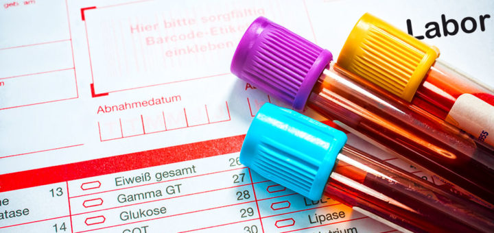 Die wichtigsten Laborwerte und ihre Bedeutung