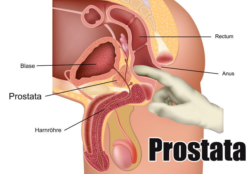 Prostata